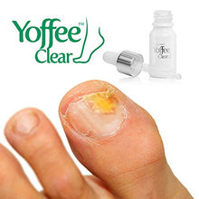 Carica l&#39;immagine nel visualizzatore di Gallery, Yoffee Clear – Trattamento ristrutturante per migliorare la salute delle...
