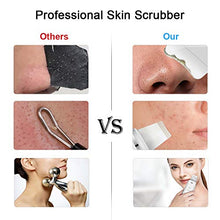 Carica l&#39;immagine nel visualizzatore di Gallery, Pulizia Viso Ultrasuoni, HailiCare Face Scrubber ad Ultrasuoni Professionale... - Ilgrandebazar
