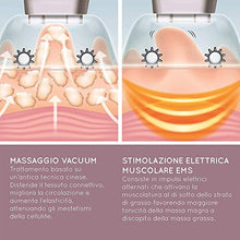 Carica l&#39;immagine nel visualizzatore di Gallery, HoMedics Smoothee - Massaggiatore Anti Cellulite ad aspirazione per pelle...