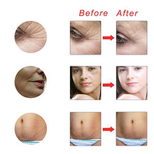 Carica l&#39;immagine nel visualizzatore di Gallery, Derma Roller Kit 3 in 1 - 0.5mm, 1.0mm, 1.5mm, il Miglior White Purple - Ilgrandebazar