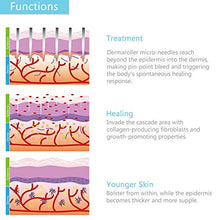 Carica l&#39;immagine nel visualizzatore di Gallery, TinkSky TS5 titanio Micro-ago Roller - 0,5 millimetri 540-aghi 0.5 mm, Nero