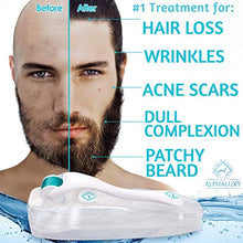 Carica l&#39;immagine nel visualizzatore di Gallery, ALPHALUXY Dermaroller 0.5 mm - Microneedling Kit per Cicatrici Acne, Aumento... - Ilgrandebazar