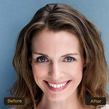 Carica l&#39;immagine nel visualizzatore di Gallery, Maschera per gli occhi, Nivlan Eye Patch, Mask, d&#39;occhio del... - Ilgrandebazar