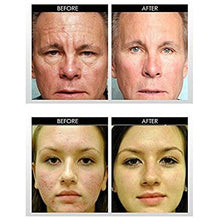 Carica l&#39;immagine nel visualizzatore di Gallery, Classic 3 in 1 Titanium Derma roller, 3 separata teste a rulli 3 1 white - Ilgrandebazar