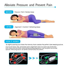 Carica l&#39;immagine nel visualizzatore di Gallery, Essort Cuscino per Le Gambe Ortopedico Ginocchia con Grigio - Ilgrandebazar