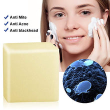 Carica l&#39;immagine nel visualizzatore di Gallery, Sapone all&#39;acne, sapone naturale fatto a mano, al viso, al...