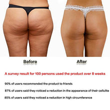 Carica l&#39;immagine nel visualizzatore di Gallery, Cupping Anti-Cellulite in Silicone, KINDAX 2pcs Coppettazione Coppe... - Ilgrandebazar
