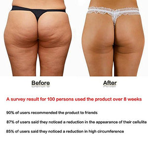Cupping Anti-Cellulite in Silicone, KINDAX 2pcs Coppettazione Coppe... - Ilgrandebazar