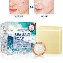 Carica l&#39;immagine nel visualizzatore di Gallery, Sapone all&#39;acne, sapone naturale fatto a mano, al viso, al...