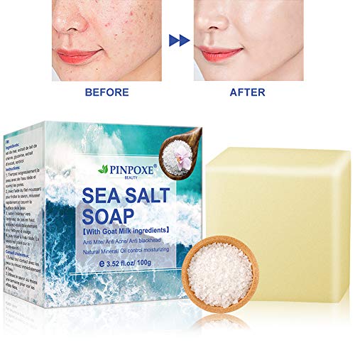 Sapone all'acne, sapone naturale fatto a mano, al viso, al...