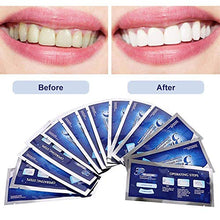 Carica l'immagine nel visualizzatore di Gallery, Denti Sbiancante,Strisce Di Sbiancamento Dei Denti,Iduce Sensibilità Dei...