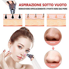 Carica l&#39;immagine nel visualizzatore di Gallery, Aspiratore Punti Neri, Neri Rimozione Pulizia di Viso USB...