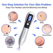 Carica l&#39;immagine nel visualizzatore di Gallery, Verruche Rimozione, ALDOM Spot Eraser Pro, Mole Removal Pen con LED Display...