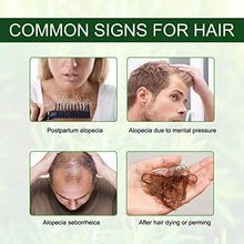 Carica l&#39;immagine nel visualizzatore di Gallery, Olio Essenziale di Rosmarino per Capelli Crescita, Rosemary Essential Oil for Hair Growth, per Capelli Secchi e Danneggiati, Stimolano la Crescita dei Capelli, Nutrono Il Cuoio Capelluto, 60 ml