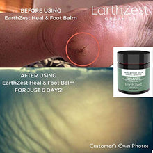 Carica l&#39;immagine nel visualizzatore di Gallery, Crema per i piedi di EarthZest Organics. Balsamo curativo e per... - Ilgrandebazar
