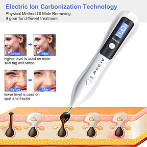 Verruche Rimozione, ALDOM Spot Eraser Pro, Mole Removal Pen con LED Display...