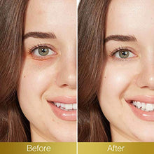 Carica l&#39;immagine nel visualizzatore di Gallery, Maschera per gli occhi Luckyfine, d&#39;occhio del collagene, Eye Care... - Ilgrandebazar