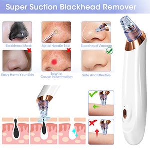 Aspiratore Punti Neri,EIVOTOR Comedone Rimozione 5 Blackhead Remover... - Ilgrandebazar