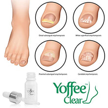 Carica l&#39;immagine nel visualizzatore di Gallery, Yoffee Clear – Trattamento ristrutturante per migliorare la salute delle...