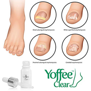 Yoffee Clear – Trattamento ristrutturante per migliorare la salute delle...