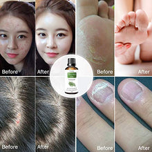 Carica l&#39;immagine nel visualizzatore di Gallery, Tea Tree Olio Essenziale 50ml 100% Naturale di Albero del Tè...