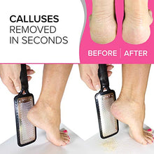 Carica l'immagine nel visualizzatore di Gallery, Lima Per Piedi ULTIMATE Rimozione Della Pelle Dura - Raspa Black Megafile