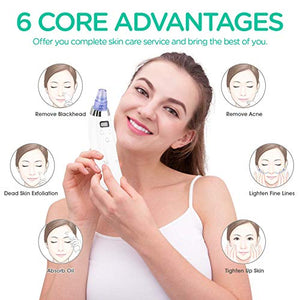 VOYOR 4-in-1 Aspiratore Togliere Punti Neri Professionale Aspira Neri... - Ilgrandebazar
