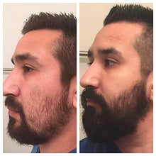 Carica l&#39;immagine nel visualizzatore di Gallery, Derma Roller - Kit per la crescita della barba, Dermaroller con 540 aghi,...