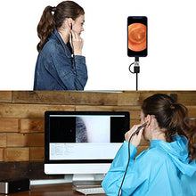Carica l&#39;immagine nel visualizzatore di Gallery, Yonimu Otoscopio Digitale a LED, Fotocamera Scope Kit di rimozione... - Ilgrandebazar