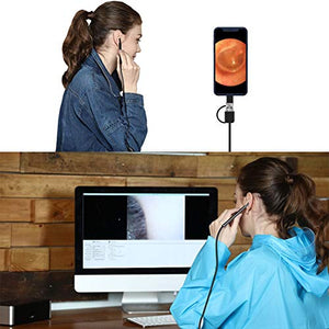 Yonimu Otoscopio Digitale a LED, Fotocamera Scope Kit di rimozione... - Ilgrandebazar