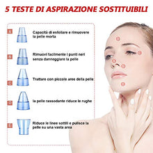 Carica l&#39;immagine nel visualizzatore di Gallery, Aspiratore Punti Neri, Neri Rimozione Pulizia di Viso USB...
