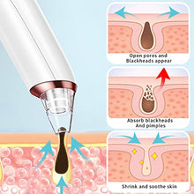 Carica l'immagine nel visualizzatore di Gallery, Aspiratore Punti Neri con 6 Sonde di Ricambio e 3 Modalità di Aspirazione Regolabili per Estrattore Comedone Brufoli Grasso