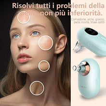 Carica l&#39;immagine nel visualizzatore di Gallery, Mosen Aspiratore Punti Neri, Pulitore dei Pori USB Ricaricabile...