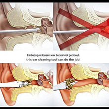 Carica l&#39;immagine nel visualizzatore di Gallery, Pulizia Orecchio, Smart Ear Cleaner, Consente una Delicata e... - Ilgrandebazar