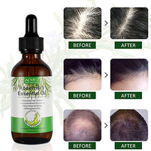 Carica l&#39;immagine nel visualizzatore di Gallery, Olio Essenziale di Rosmarino per Capelli Crescita, Rosemary Essential Oil for Hair Growth, per Capelli Secchi e Danneggiati, Stimolano la Crescita dei Capelli, Nutrono Il Cuoio Capelluto, 60 ml