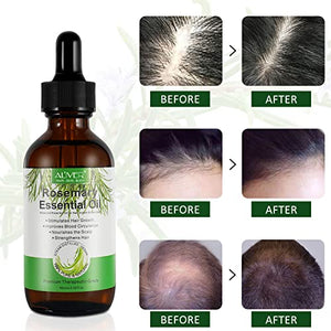 Olio Essenziale di Rosmarino per Capelli Crescita, Rosemary Essential Oil for Hair Growth, per Capelli Secchi e Danneggiati, Stimolano la Crescita dei Capelli, Nutrono Il Cuoio Capelluto, 60 ml