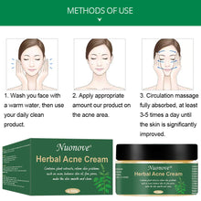 Carica l&#39;immagine nel visualizzatore di Gallery, Acne Crema, Crema Anti Acne, Cicatrici Viso... - Ilgrandebazar