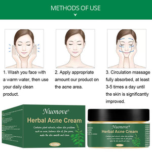 Acne Crema, Crema Anti Acne, Cicatrici Viso... - Ilgrandebazar