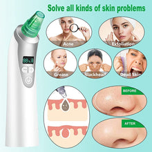 Carica l'immagine nel visualizzatore di Gallery, Aspiratore Punti Neri,Aspiratore Punti Neri Vacuum,Rimozione di Comedone,Blackhead Remover Vacuum,Macchina USB ricaricabile per rimuovere i punti neri per la pulizia del naso del viso green