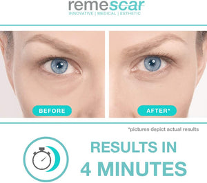Remescar - Borse Occhi e Occhiaie Scure - Crema per le borse sotto gli occhi - Eliminare le borse sotto gli occhi - Trattamento istantaneo per eliminare le borse sotto gli occhi per uomo e donna