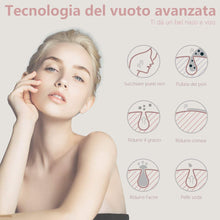 Carica l&#39;immagine nel visualizzatore di Gallery, Mosen Aspiratore Punti Neri Rimozione di Comedone Pulitore dei Pori Professionale Estrattore Vacuum Punti Neri Ricaricabile USB, Display a LED e 5 Testine per Rimozione di Comedoni, Brufoli, Grasso