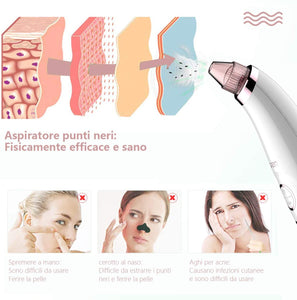 Mosen Aspiratore Punti Neri Rimozione di Comedone Pulitore dei Pori Professionale Estrattore Vacuum Punti Neri Ricaricabile USB, Display a LED e 5 Testine per Rimozione di Comedoni, Brufoli, Grasso