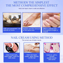 Carica l&#39;immagine nel visualizzatore di Gallery, Funghi Unghie Trattamento,Trattamento Unghie,Fungo Unghie Piedi,Antimicotico,Fungus trattamento crema piedi nail protezione anti fungine delle unghie riparazione Unguento