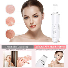 Carica l&#39;immagine nel visualizzatore di Gallery, ANLAN Skin Scrubber Dispositivo per Viso Peeling Spazzola Pulizia White - Ilgrandebazar