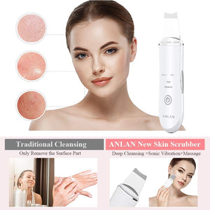 ANLAN Skin Scrubber Dispositivo per Viso Peeling Spazzola Pulizia White - Ilgrandebazar