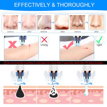 Carica l'immagine nel visualizzatore di Gallery, Aspiratore Punti Neri, AVWOO Elettrico Per i Pori del Viso, con 5... - Ilgrandebazar