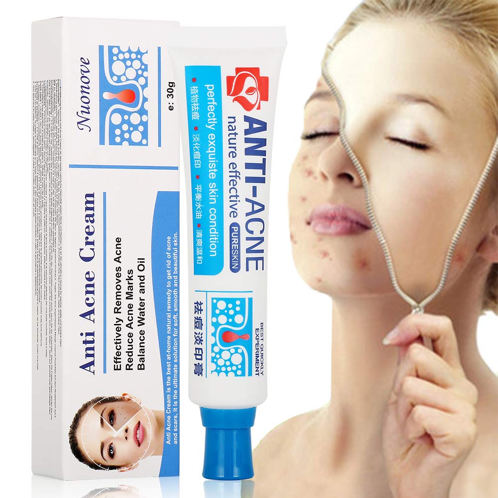 Acne Crema, Crema Anti Acne, Cicatrici Viso 30g - Ilgrandebazar
