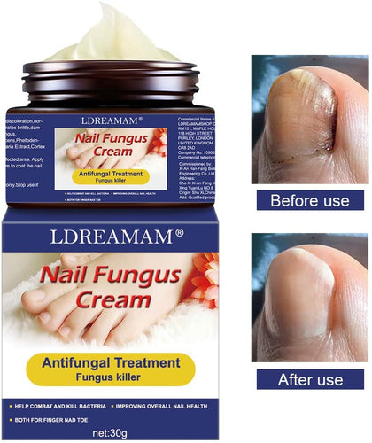 Funghi Unghie Trattamento,Trattamento Unghie,Fungo Unghie Piedi,Antimicotico,Fungus trattamento crema piedi nail protezione anti fungine delle unghie riparazione Unguento