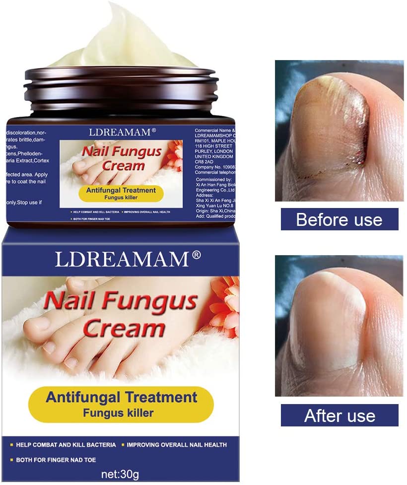 Funghi Unghie Trattamento,Trattamento Unghie,Fungo Unghie Piedi,Antimicotico,Fungus trattamento crema piedi nail protezione anti fungine delle unghie riparazione Unguento
