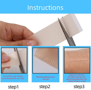 Fogli cicatriziali in silicone, ustione da acne, cesareo, chirurgia, cheloide, trattamento di cicatrici vecchie e nuove, strisce di tessuto adesivo morbido, 3,5 x7,5 cm, 4 fogli riutilizzabili
